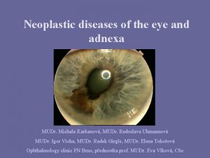 Neoplastic diseases of the eye and adnexa MUDr