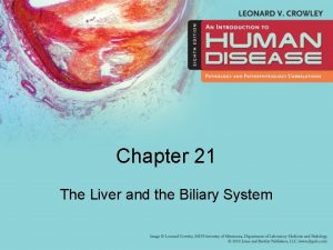 Chapter 21 The Liver and the Biliary System