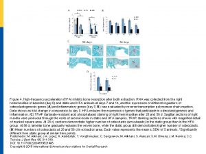 Figure 4 Highfrequency acceleration HFA inhibits bone resorption