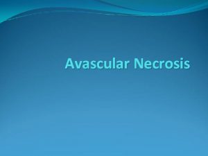Avascular Necrosis Outline Definition Pathophysiology Aetiology Presentation Imaging