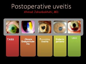 Postoperative uveitis Ahmad Jahanbakhshi MD TASS Chronic Endophthalm