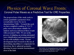 Physics of Coronal Wave Fronts Coronal Pulse Waves