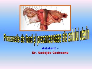 Asistent Dr Nadejda Codreanu Cancerul de col apare