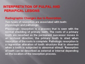 INTERPRETATION OF PULPAL AND PERIAPICAL LESIONS Radiographic Changes