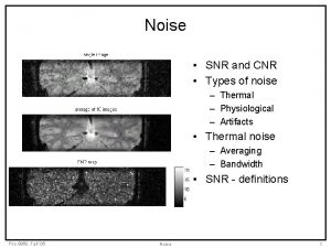 Noise SNR and CNR Types of noise Thermal