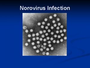 Norovirus Infection Norovirus Terminology n Also known as