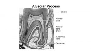 Alveolar Process Gingiva Alveolar bone composed of a