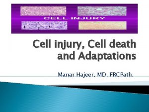 Cell injury Cell death and Adaptations Manar Hajeer