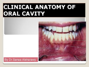 CLINICAL ANATOMY OF ORAL CAVITY By Dr Sanaa