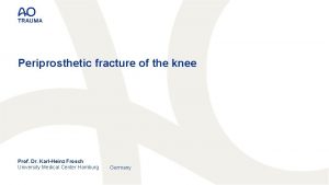 Periprosthetic fracture of the knee Prof Dr KarlHeinz