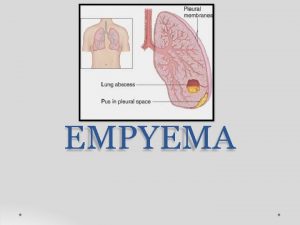 EMPYEMA Empyema An accumulation of thick purulent fluid