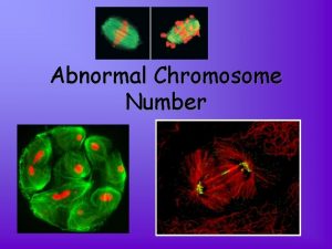 Abnormal Chromosome Number A Change in Chromosome Number