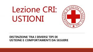 Lezione CRI USTIONI DISTINZIONE TRA I DIVERSI TIPI