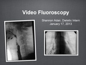Video Fluoroscopy Shannon Adair Dietetic Intern January 17