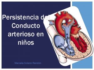 Persistencia del conducto arterioso