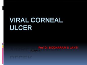 VIRAL CORNEAL ULCER Prof Dr SIDDHARAM S JANTI