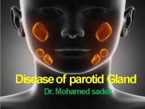 Disease of parotid Gland Dr Mohamed sadek SYLLABUS