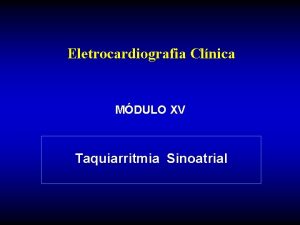 Eletrocardiografia Clnica MDULO XV Taquiarritmia Sinoatrial Taquiarritmias Supraventriculares