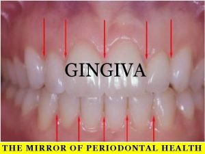 GINGIVA THE MIRROR OF PERIODONTAL HEALTH CONTENTS q
