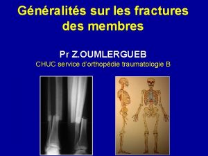 Gnralits sur les fractures des membres Pr Z