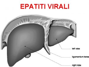 EPATITI VIRALI DEFINIZIONE Con il termine EPATITE VIRALE