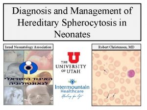 Diagnosis and Management of Hereditary Spherocytosis in Neonates