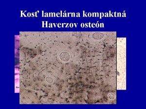 Kos lamelrna kompaktn Haverzov osten Kos pongizna hubovit