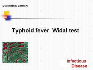 Microbiology labratory Typhoid fever Widal test Infectious Disease