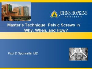 Masters Technique Pelvic Screws in Why When and