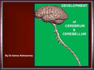 DEVELOPMENT of CEREBRUM CEREBELLUM By Dr Sanaa Alshaarawy