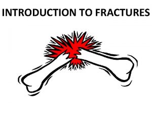 INTRODUCTION TO FRACTURES OBJECTIVES To define fractures and