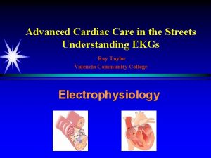 Advanced Cardiac Care in the Streets Understanding EKGs