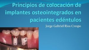 Principios de colocacin de implantes osteointegrados en pacientes