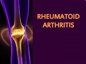 RHEUMATOID ARTHRITIS Rheumatoid Arthritis A chronic autoimmune disease
