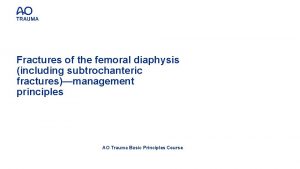 Fractures of the femoral diaphysis including subtrochanteric fracturesmanagement