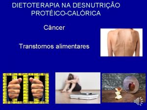 DIETOTERAPIA NA DESNUTRIO PROTICOCALRICA Cncer Transtornos alimentares A