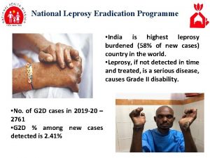 National Leprosy Eradication Programme India is highest leprosy