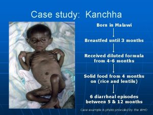 Case study Kanchha Born in Malawi Breastfed until