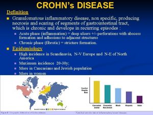 CROHNs DISEASE Definition n Granulomatous inflammatory disease non