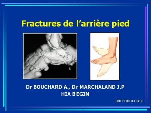 Fractures de larrire pied Dr BOUCHARD A Dr