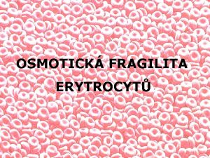 OSMOTICK FRAGILITA ERYTROCYT TEST OSMOTICK FRAGILITY DEFINICE test