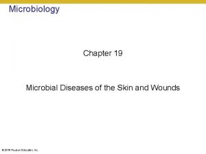 Microbiology Chapter 19 Microbial Diseases of the Skin