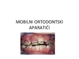 MOBILNI ORTODONTSKI APARATII Mobilni ortodontski aparati primenjuju se