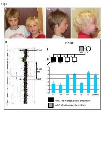 Fig 1 Aiii Ai B PRS 183 KCNJ