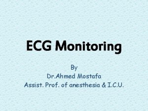 ECG Monitoring By Dr Ahmed Mostafa Assist Prof