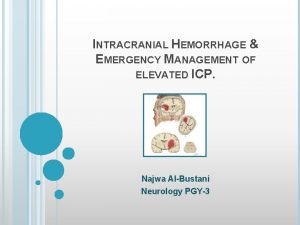 INTRACRANIAL HEMORRHAGE EMERGENCY MANAGEMENT OF ELEVATED ICP Najwa