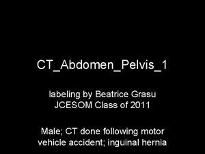 CTAbdomenPelvis1 labeling by Beatrice Grasu JCESOM Class of
