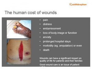 The human cost of wounds pain distress embarrassment