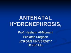 ANTENATAL HYDRONEPHROSIS Prof Hashem AlMomani Pediatric Surgeon JORDAN