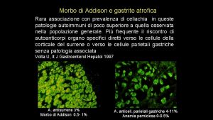 Morbo di Addison e gastrite atrofica Rara associazione